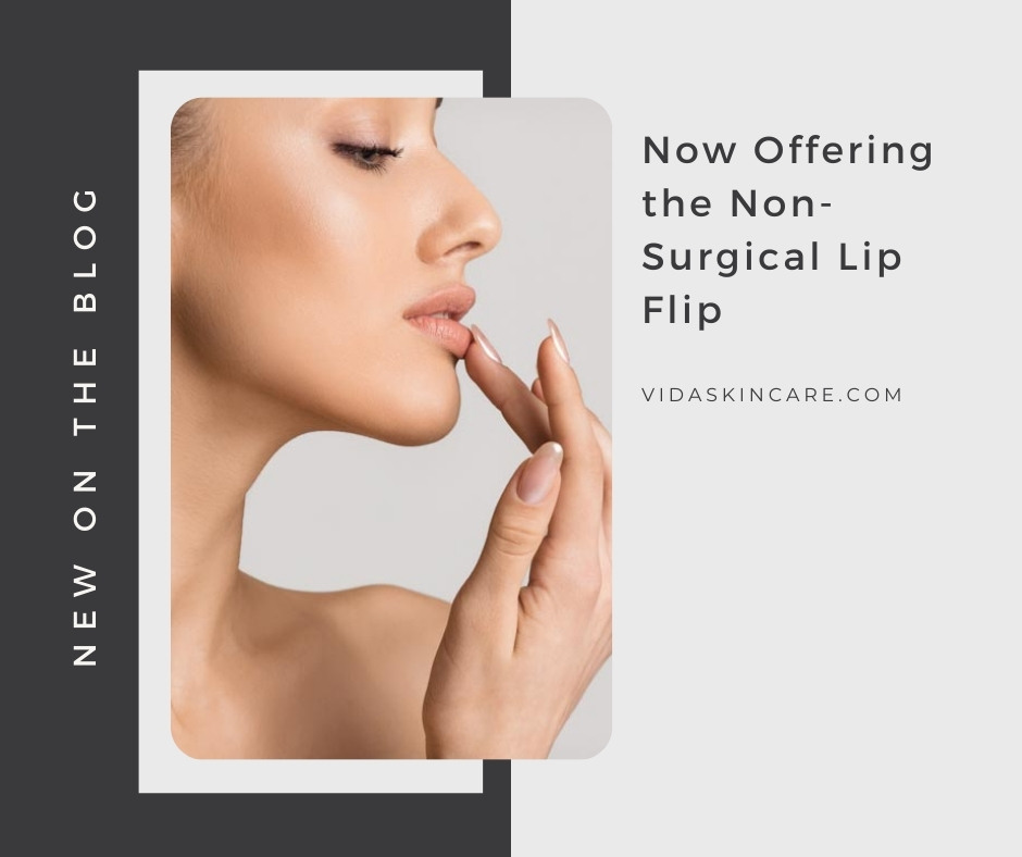 Now Offering the Non-Surgical Lip Flip | VIDA Aesthetic Medicine, Salem