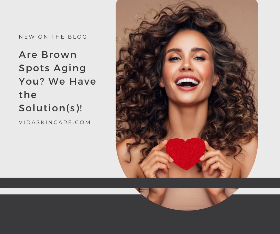 Are Brown Spots Aging You_ We Have the Solution(s)!