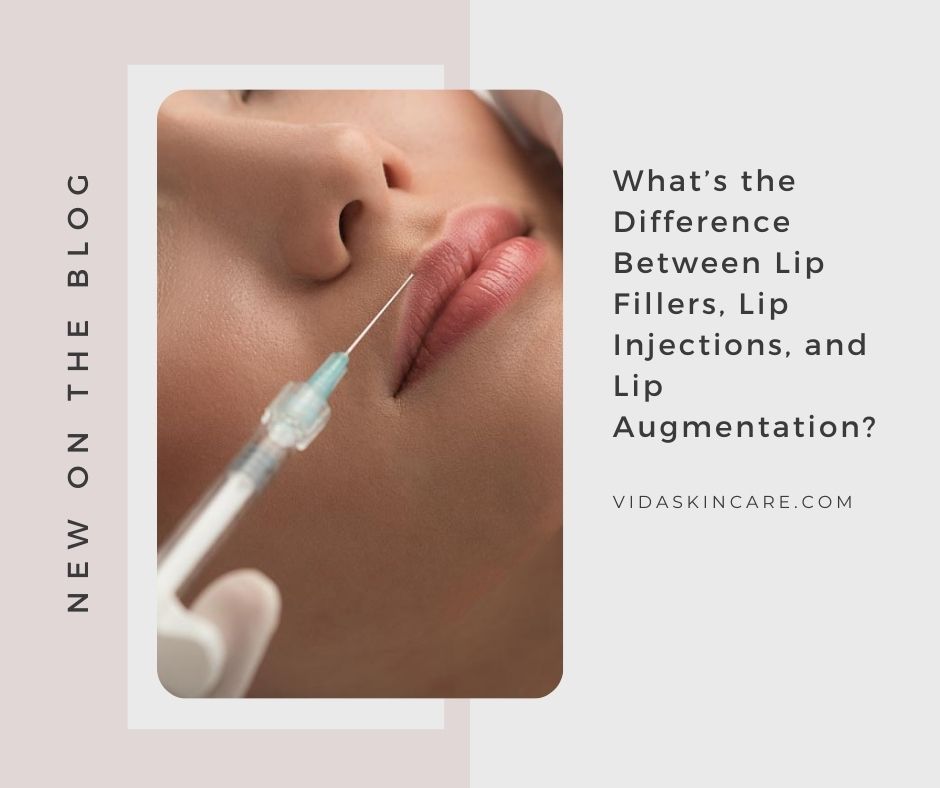 Lip Fillers, Lip Injections, or Lip Augmentation? | VIDA Aesthetic Medicine