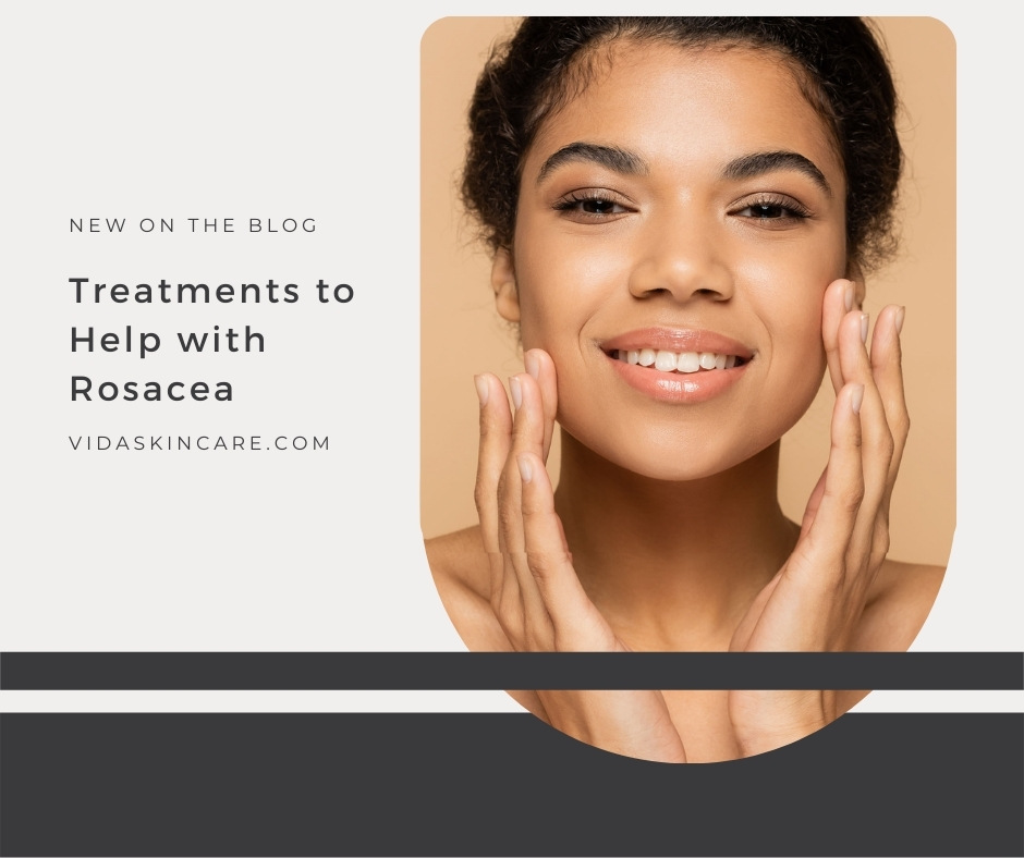 Treatments to Help with Rosacea | VIDA Aesthetic Medicine, Salem