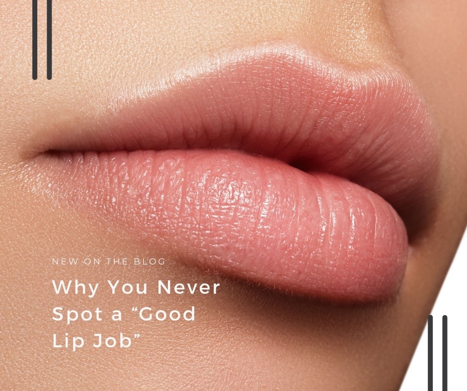 Why You Never Spot a “Good Lip Job” | VIDA Aesthetic Medicine