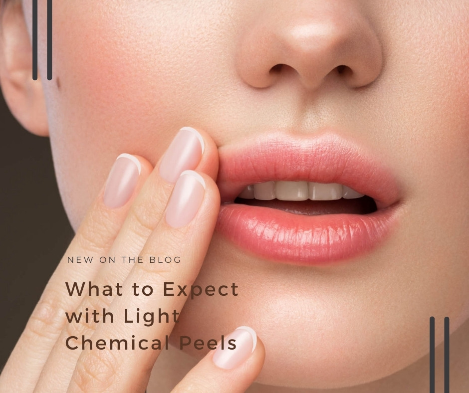 What to Expect with Light Chemical Peels | VIDA Aesthetic Medicine