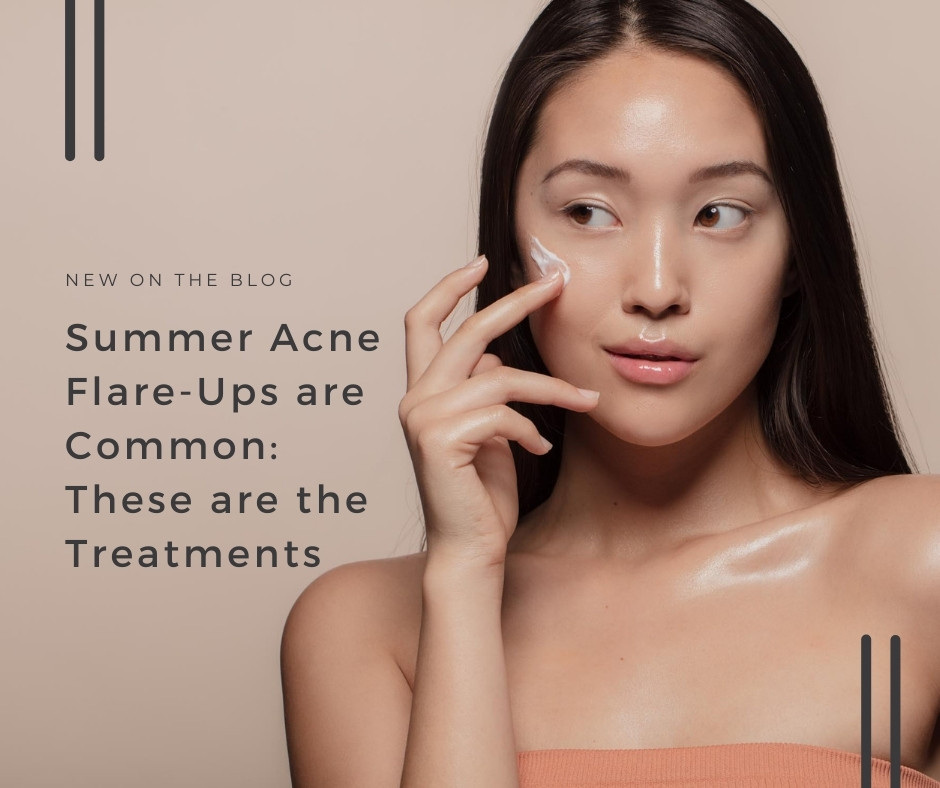 Summer Acne Flare-Ups are Common | VIDA Aesthetic Medicine, Salem