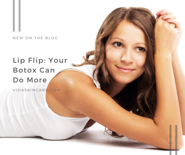 Lip Flip Your Botox Can Do More VIDA Aesthetic Medicine