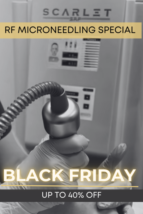 Black Friday RF Microneedling Special | VIDA Aesthetic Medicine Salem, OR and Tigard, OR