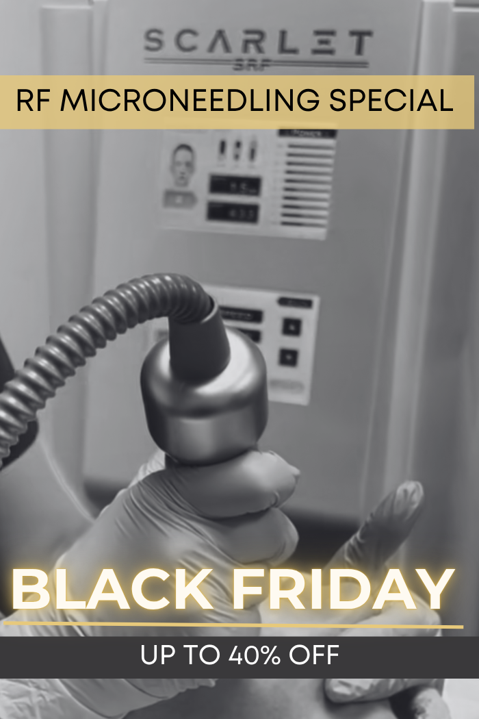Black Friday RF Microneedling Special | VIDA Aesthetic Medicine Salem, OR and Tigard, OR Black Friday RF Microneedling Special | VIDA Aesthetic Medicine Salem, OR and Tigard, OR
