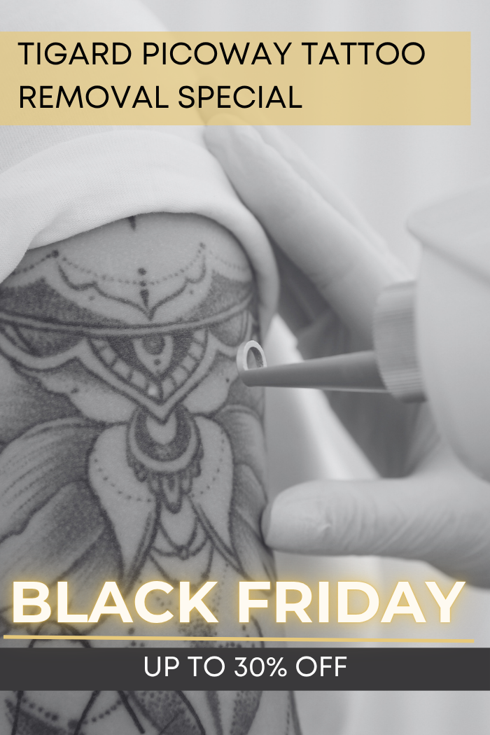 Tigard Black Friday Tattoo Removal Special | VIDA Aesthetic Medicine Tigard, OR Tigard Black Friday Tattoo Removal Special | VIDA Aesthetic Medicine Tigard, OR