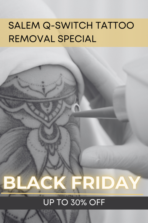 Salem Black Friday Tattoo Removal Special | VIDA Aesthetic Medicine Salem, OR