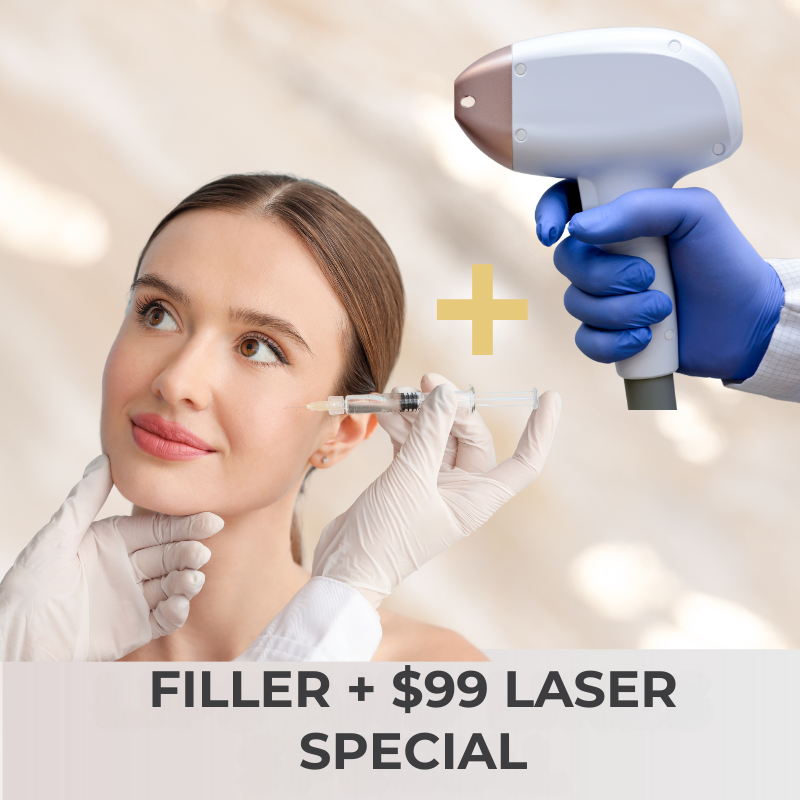 Filler and $99 laser treatment special| VIDA Aesthetic Medicine Tigard, OR