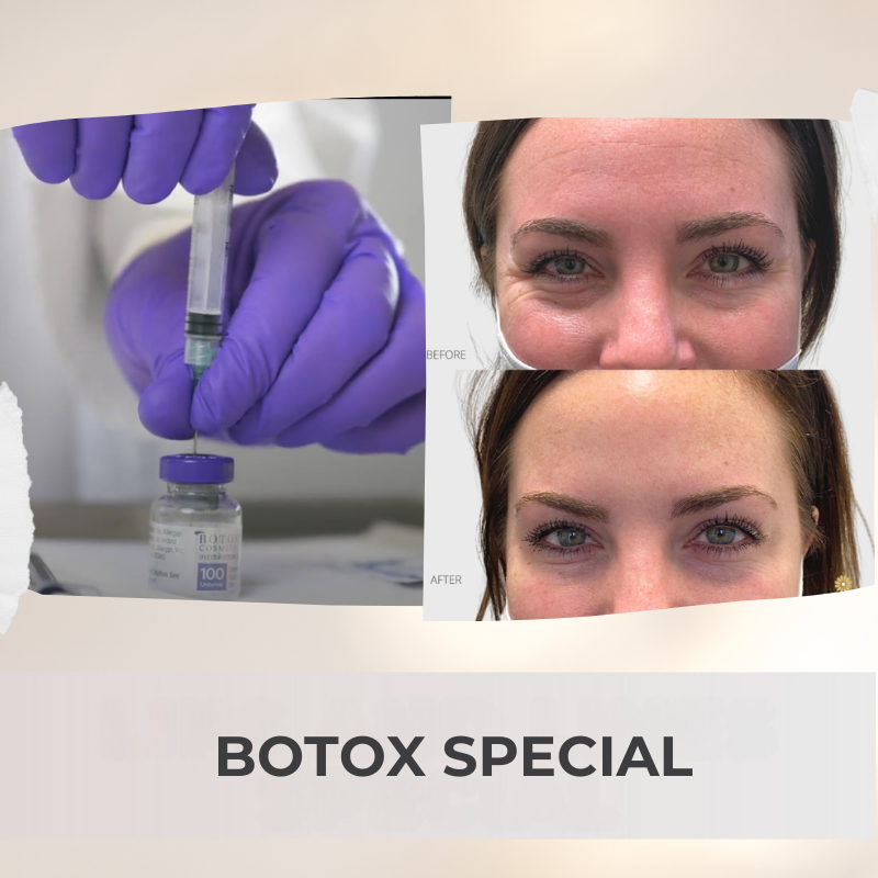 VIDA Aesthetic Medicine Salem, OR| Botox special