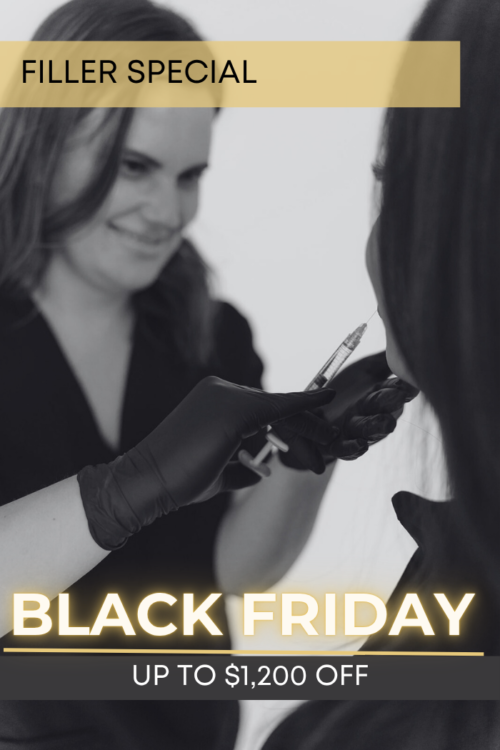 Black Friday Filler Special | VIDA Aesthetic Medicine Salem, OR and Tigard, OR
