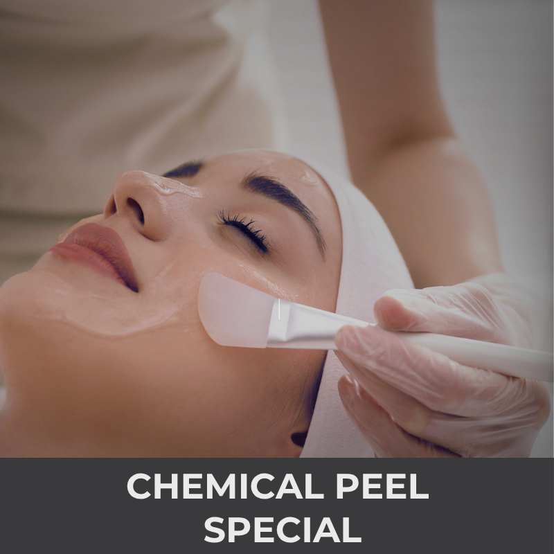 Chemical Peel Special | VIDA Aesthetic Medicine Salem, OR and Tigard, OR