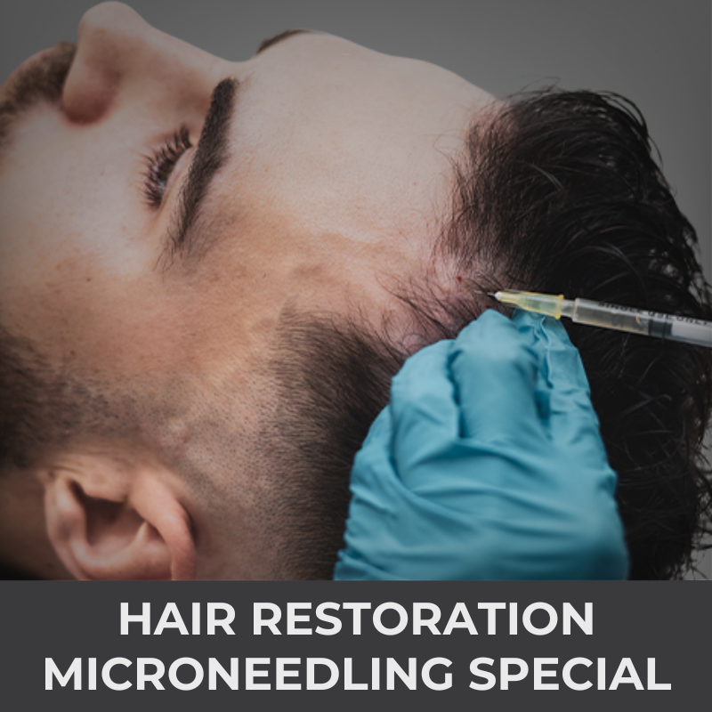 Hair Restoration Microneedling Special | VIDA Aesthetic Medicine Salem, OR and Tigard, OR