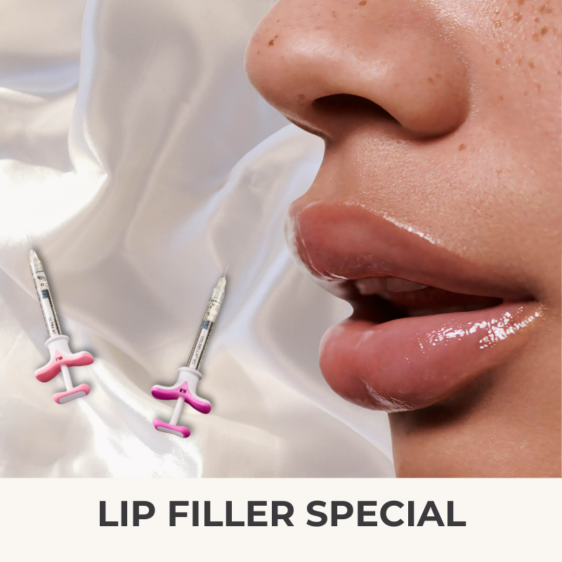 February Lip Filler Special | VIDA Aesthetic Medicine Salem, OR and Tigard. OR