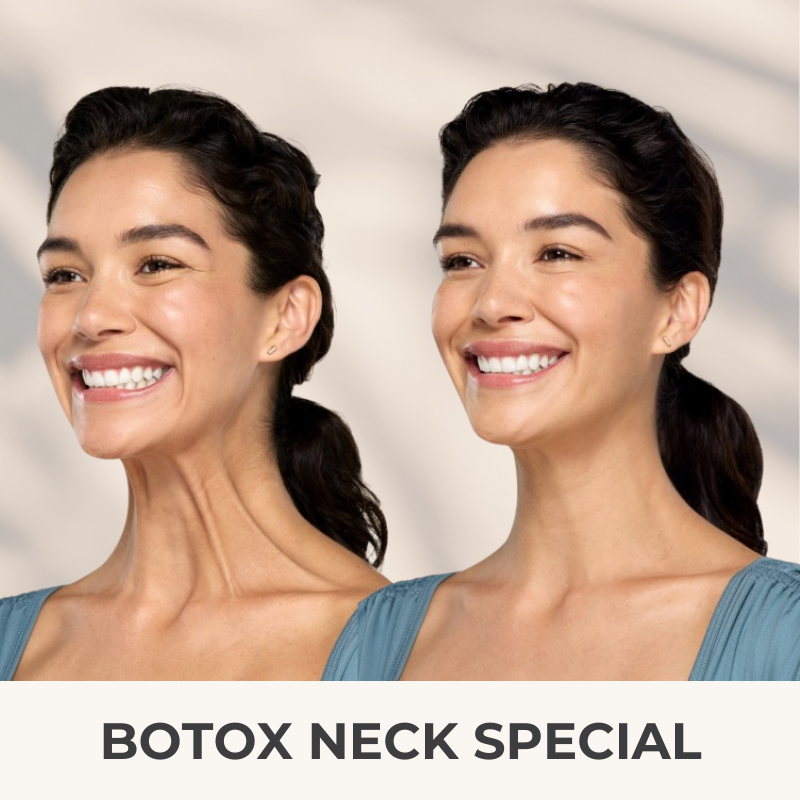 Botox Neck Lift Special | VIDA Aesthetic Medicine Salem, OR and Tigard, OR