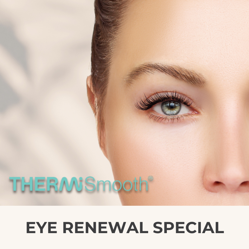 THERMI March Special 2026 Tigard Thermi Eye Special | VIDA Aesthetic Medicine Tigard, OR and Salem, OR