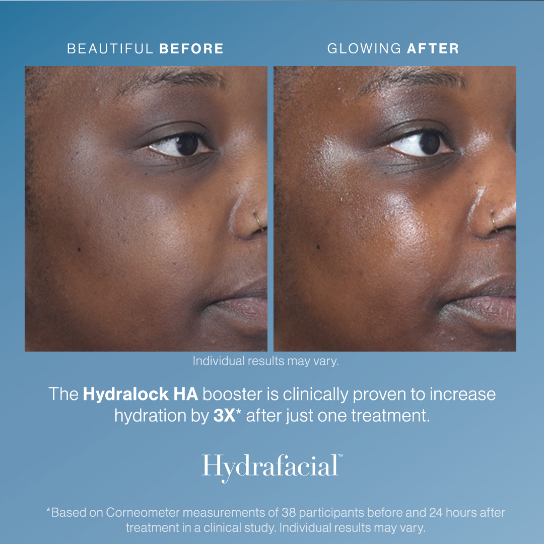 How Professionals Achieve Glass Skin: A Complete Guide